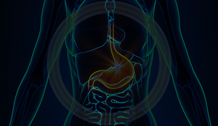 The Agonizing Spiral: Unveiling the Culprits and Solutions of Gastroesophageal Reflux Disease (GERD) 
