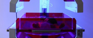 Premature Birth and Its Impact on Newborns